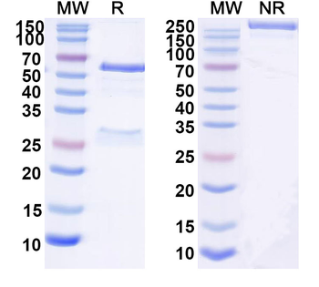 SARS-CoV-2 RBD Human Monoclonal Antibody