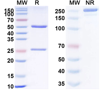 CD120b/TNFRSF1B/TNFR2 Human Monoclonal Antibody