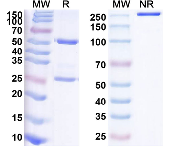 CSF1/M-CSF Human Monoclonal Antibody