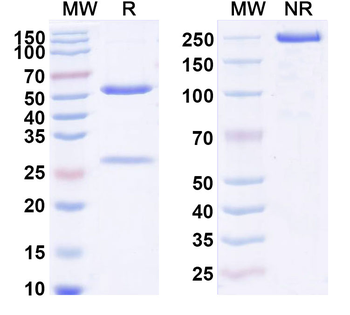 IL25/IL17E Human Monoclonal Antibody