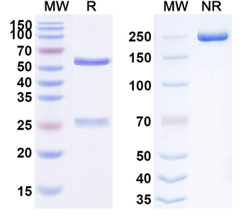 FGF21 Human Monoclonal Antibody
