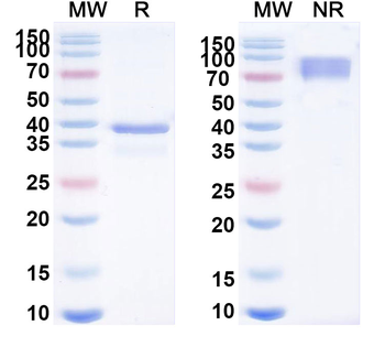 Atacicept Monoclonal Antibody