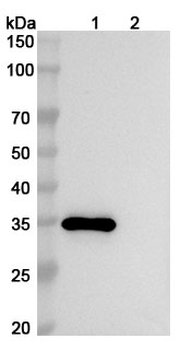 CD66c/CEACAM6 Human Monoclonal Antibody