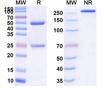ADM/Adrenomedullin Human Monoclonal Antibody