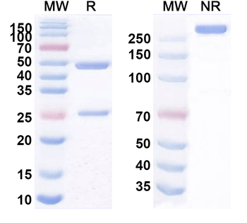VSIG4/CRIg Human Monoclonal Antibody