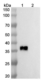 Betifisolimab Chimeric Monoclonal Antibody