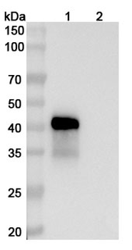 Vepsitamab Human Monoclonal Antibody