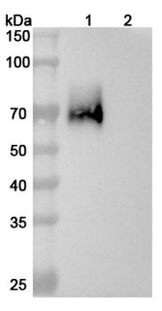 Obrindatamab Human Monoclonal Antibody
