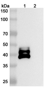 Ebdarokimab Human Monoclonal Antibody