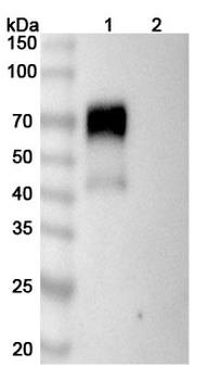 Sarilumab Human Monoclonal Antibody
