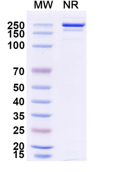 Palivizumab Human Monoclonal Antibody
