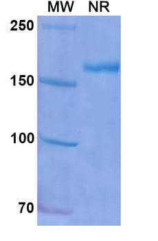 Exbivirumab Human Monoclonal Antibody