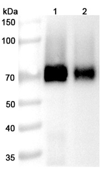 Codrituzumab Human Monoclonal Antibody