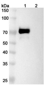 Tacatuzumab Human Monoclonal Antibody