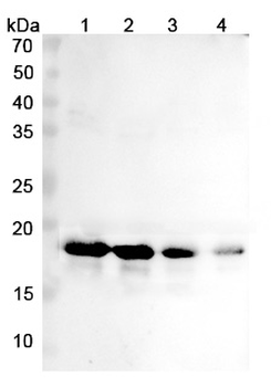 Cinpanemab Human Monoclonal Antibody