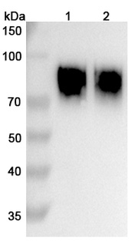 Anifrolumab Human Monoclonal Antibody