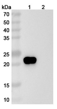Human GITR/TNFRSF18 Reference Antibody (Ragifilimab, RUO)