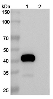 Human TRAIL R2/TNFRSF10B Reference Antibody (Drozitumab, RUO)