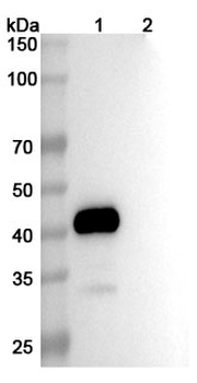 Conatumumab Human Monoclonal Antibody
