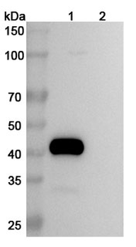 Tigatuzumab Human Monoclonal Antibody