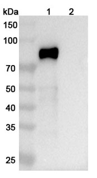 Lacutamab Human Monoclonal Antibody