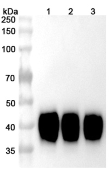 Tisotumab Human Monoclonal Antibody