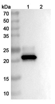 Clazakizumab Human Monoclonal Antibody