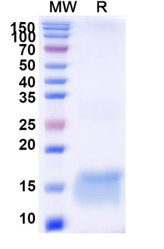 Nipah virus/NiV Fusion glycoprotein Nanobody Antibody