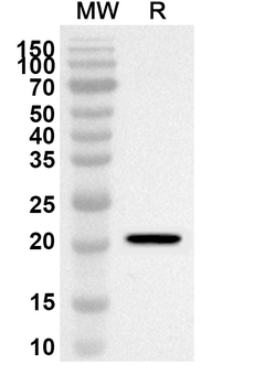 CHIKV Capsid Protein Polyclonal Antibody