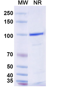 Nav1.4/Nav1.5 Na+ channel Antibody