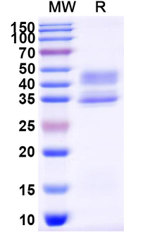 Recombinant Mouse ACVR1B Protein, C-Fc