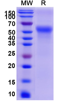 Recombinant Human CD46 Protein, C-His