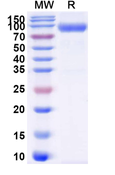 Recombinant Human CD116/CSF2RA Protein, C-Fc