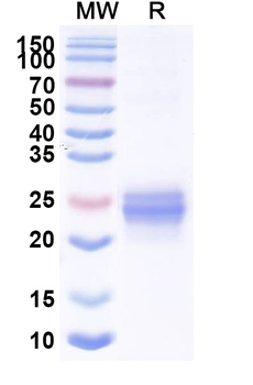Recombinant Mouse EFNA1 Protein, C-His