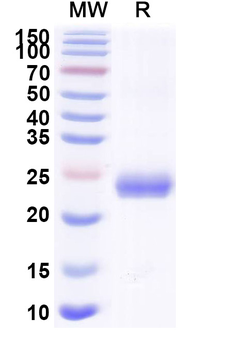 Recombinant Mouse EFNA4 Protein, C-His