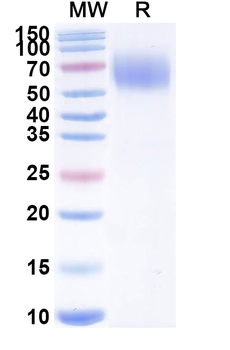 Recombinant Mouse CD172a/SIRPA Protein, C-His