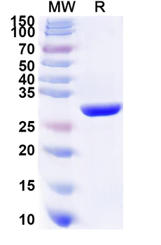 Recombinant Human COL9A1 Protein, N-His
