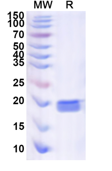 Recombinant Human NCBP2 Protein, N-His