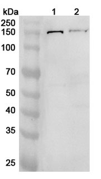 TGFBR3 Polyclonal Antibody