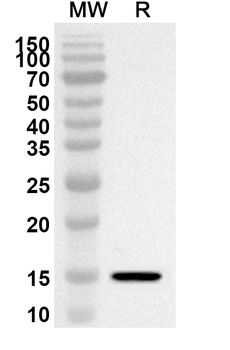 Human DLGAP5 Polyclonal Antibody