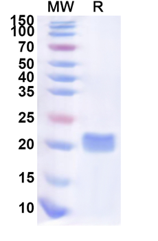 Recombinant Human ME3 Protein, N-His