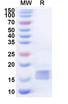 Recombinant Human BTLA Protein, N-His
