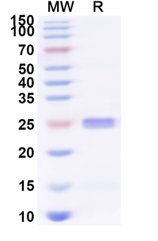 Recombinant Human CRTAM Protein, N-His