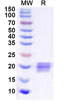 Recombinant Human UBE2H Protein, N-His