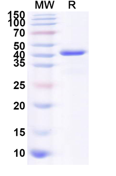 Recombinant Human CHI3L2 Protein, N-His