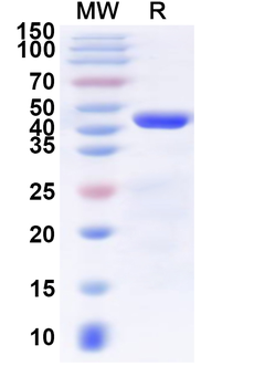 Recombinant Human SLC31A1 Protein, N-GST & C-His