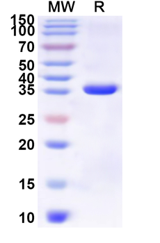 Recombinant Human CD3G Protein, N-GST & C-His