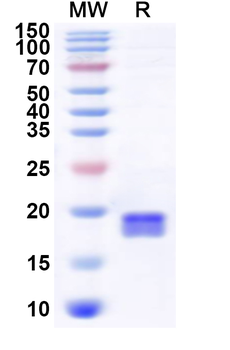 Recombinant Human UBE2A Protein, N-His