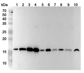 UBE2A Polyclonal Antibody