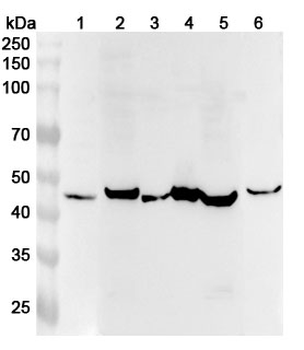 STARD3 Polyclonal Antibody